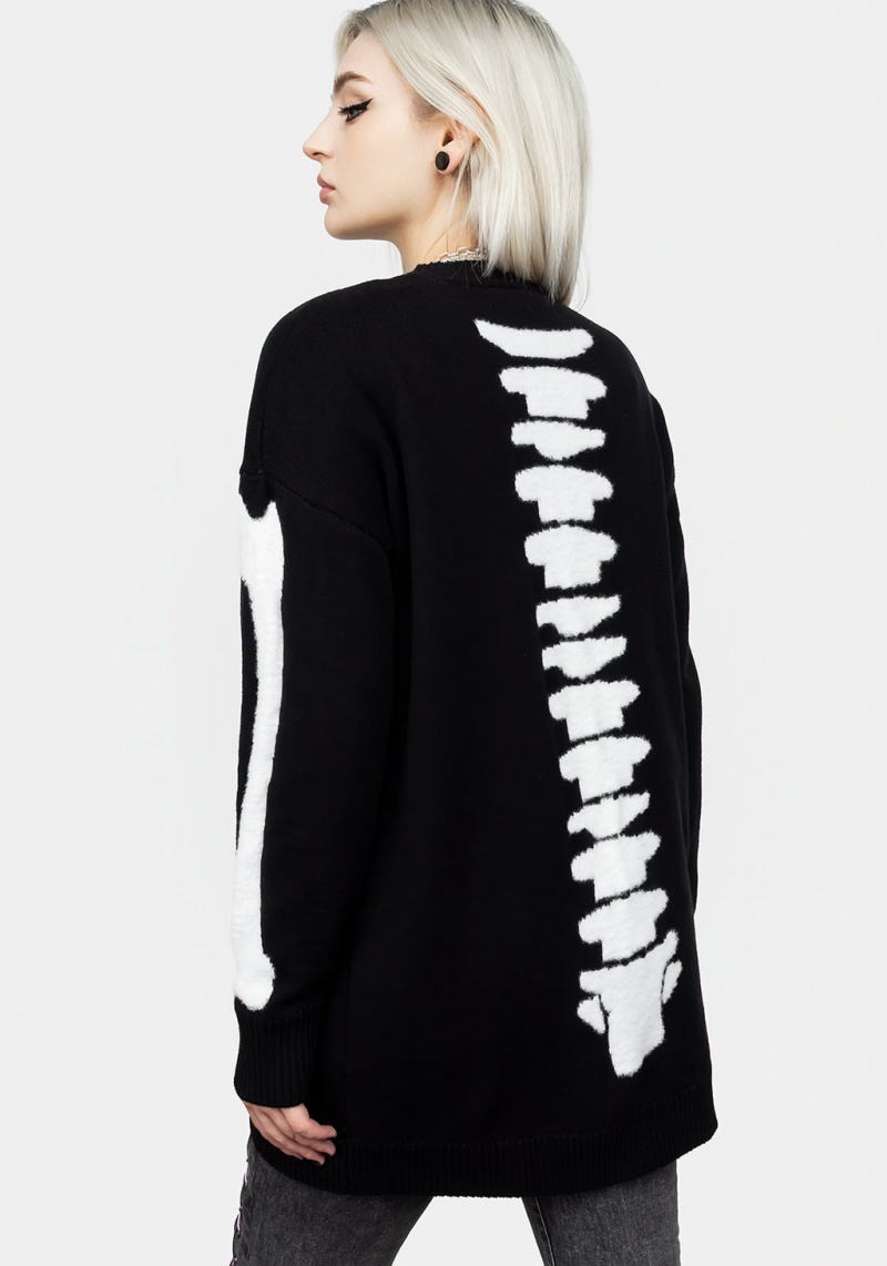 Disturbia Skeletus Oversized Cardigan | BL9520713