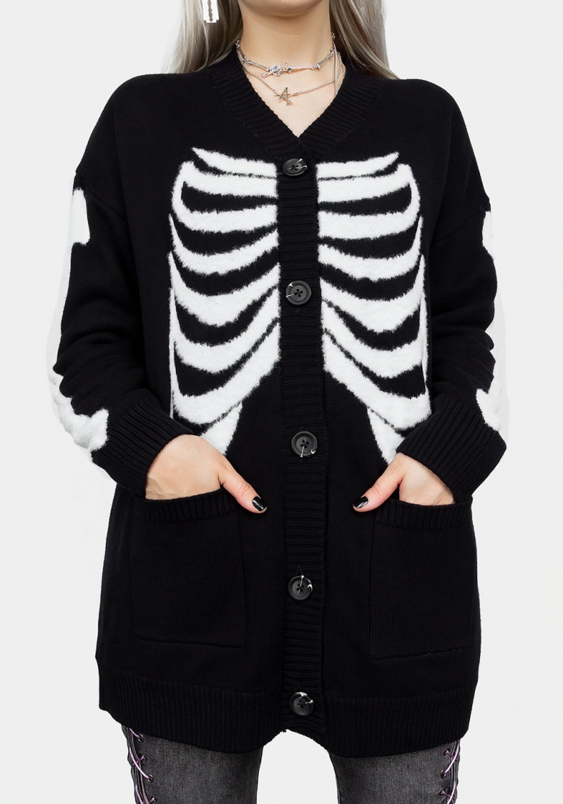 Disturbia Skeletus Oversized Cardigan | BL9520713